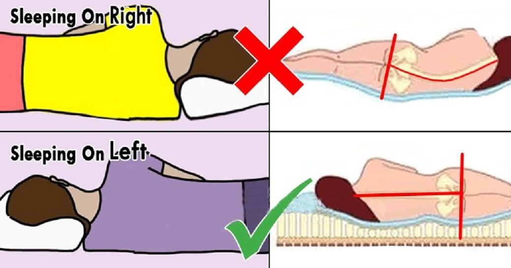 left-side-SLEEPING